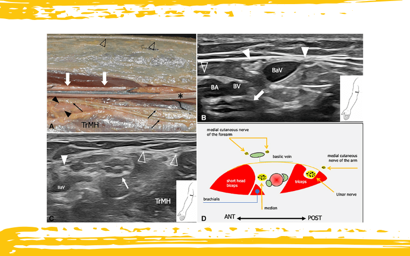 5. Nervio cutaneo medial antebrazo tempo formacion.png